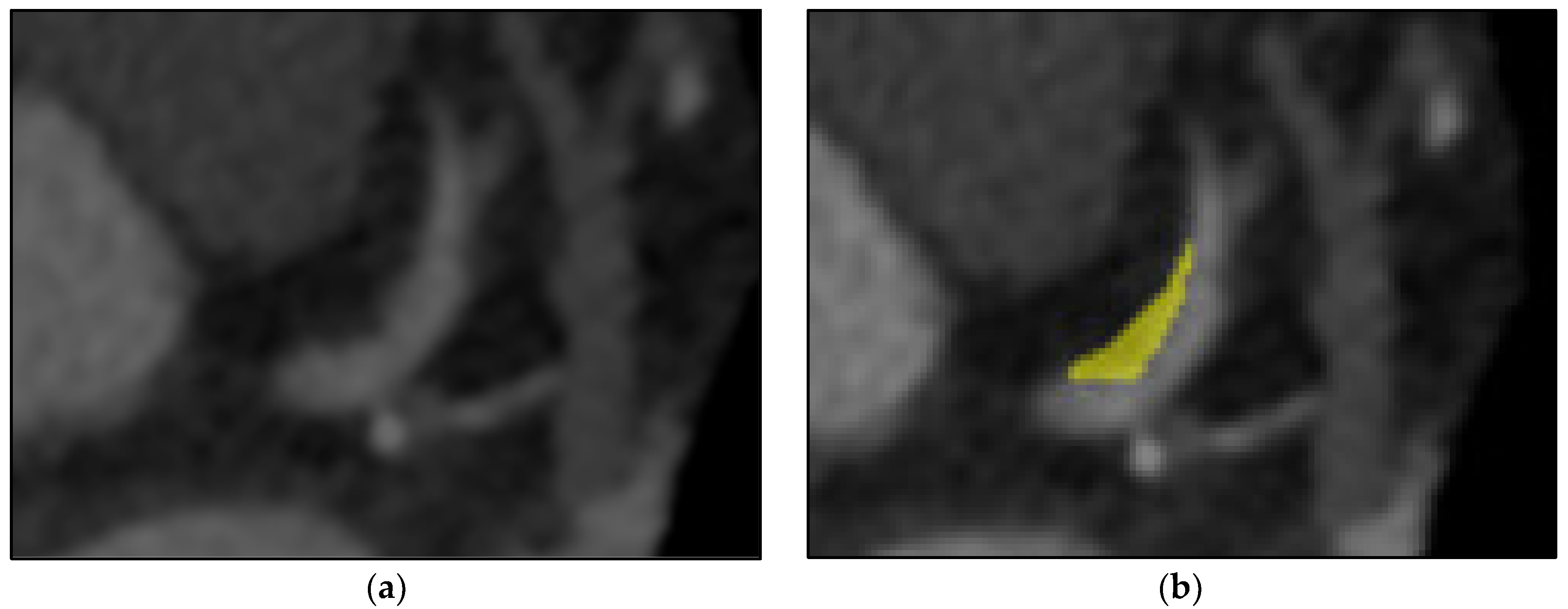 Diagnostics 12 01660 g004