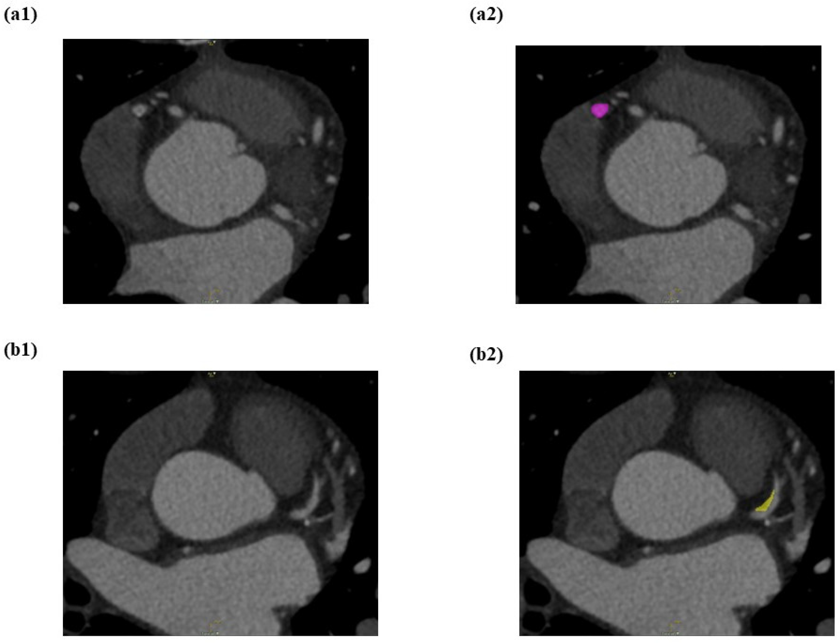 Diagnostics 12 01660 g005a