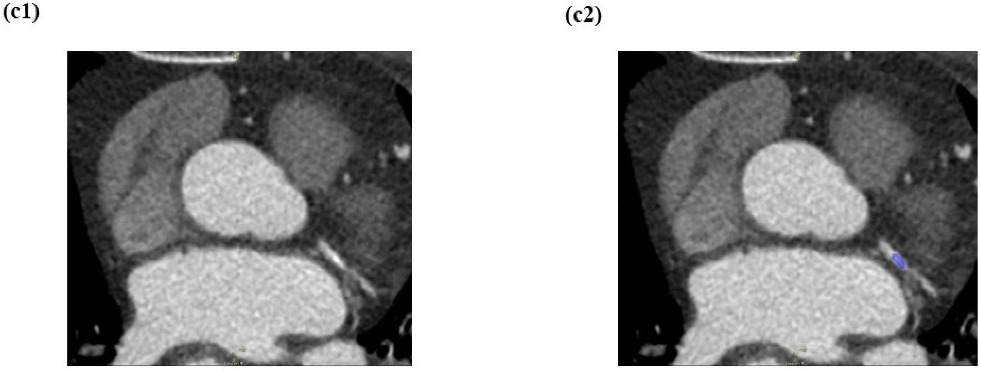 Diagnostics 12 01660 g005b