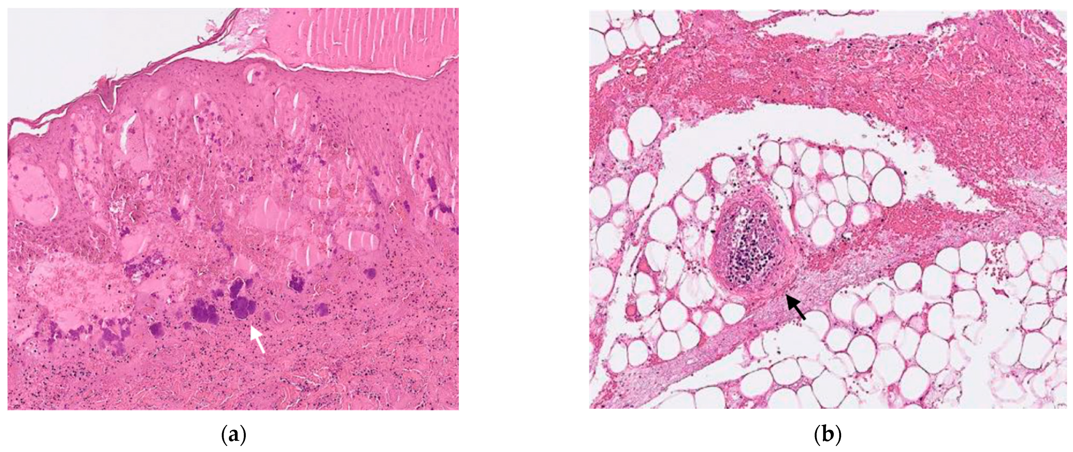 Diagnostics 12 01683 g002