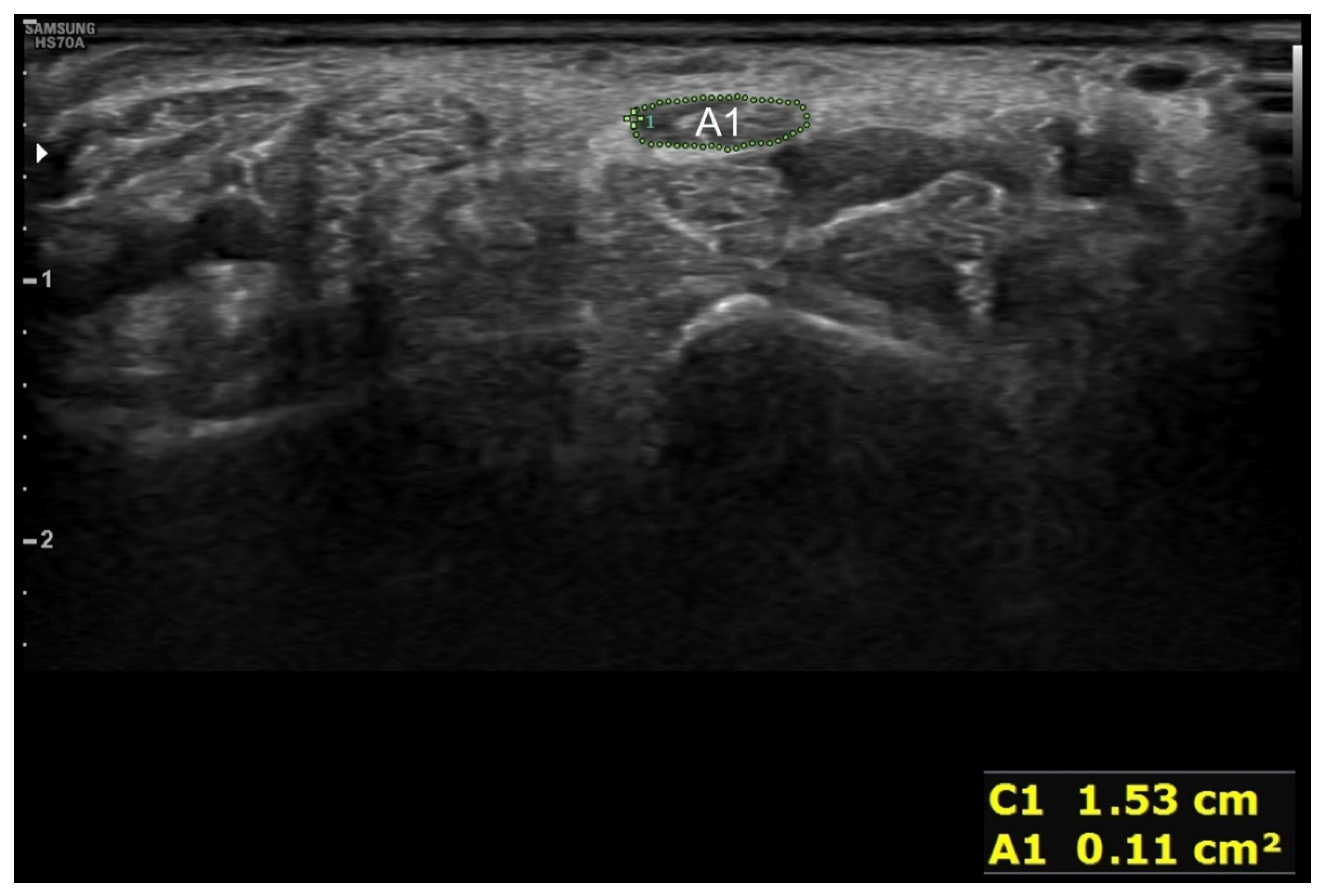 Diagnostics 12 01707 g003