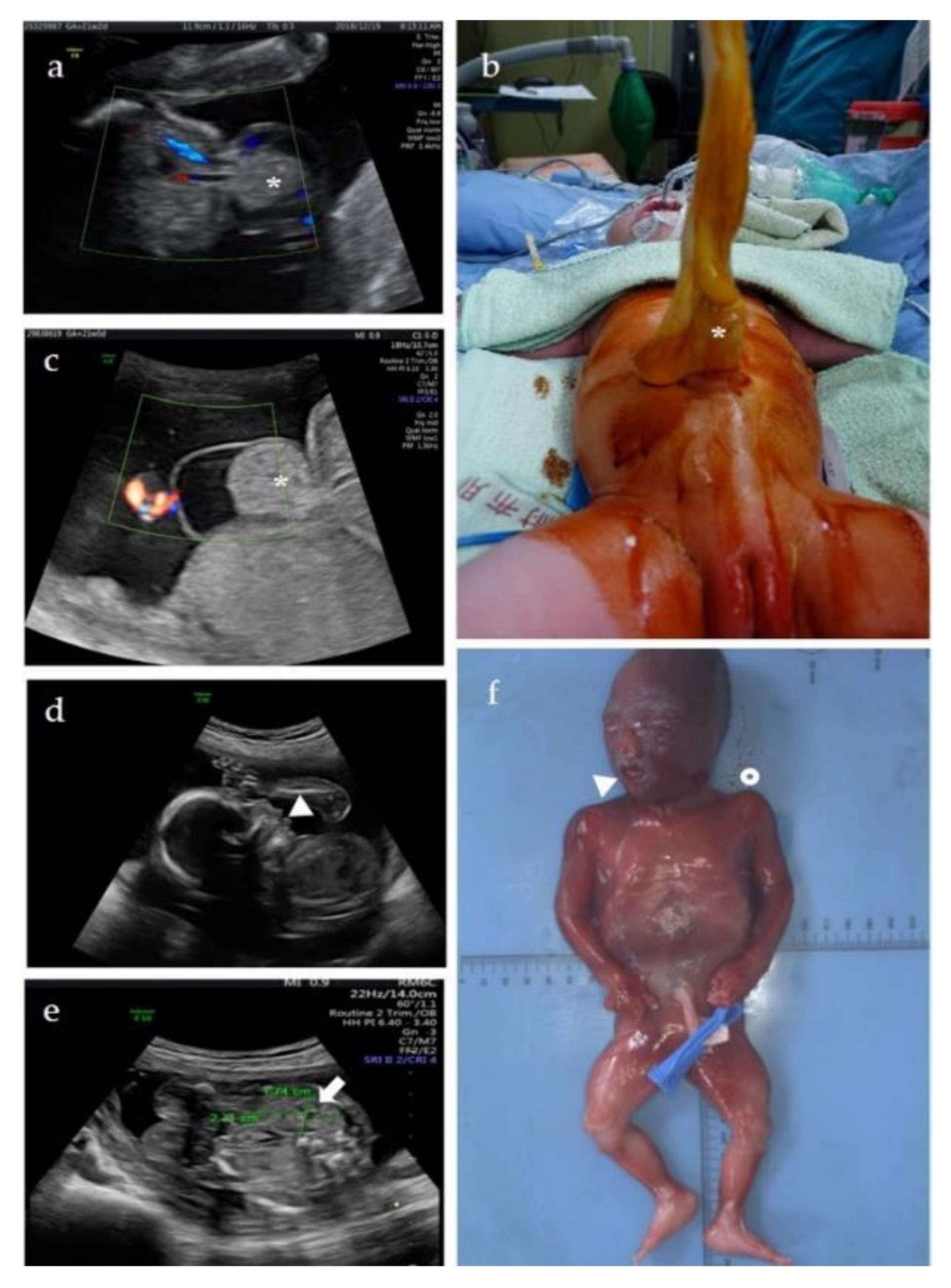 Diagnostics 12 01709 g003 Diagnostics 12 01709 g003