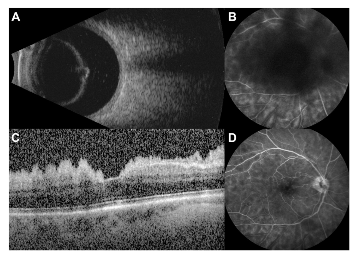 Diagnostics 12 01712 g001