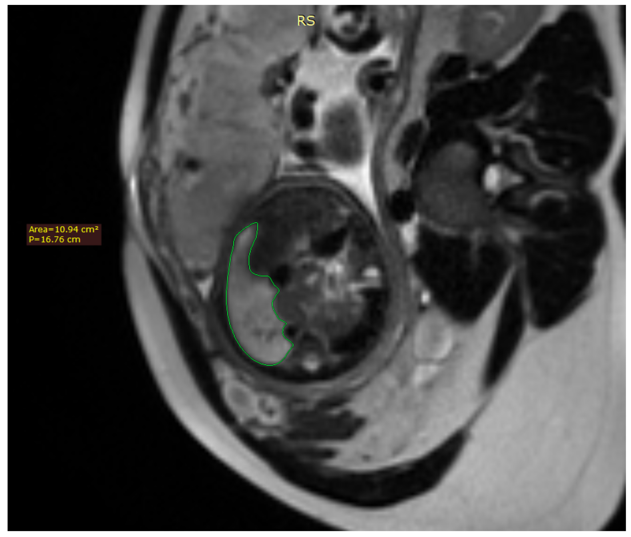 Diagnostics 12 01733 g001