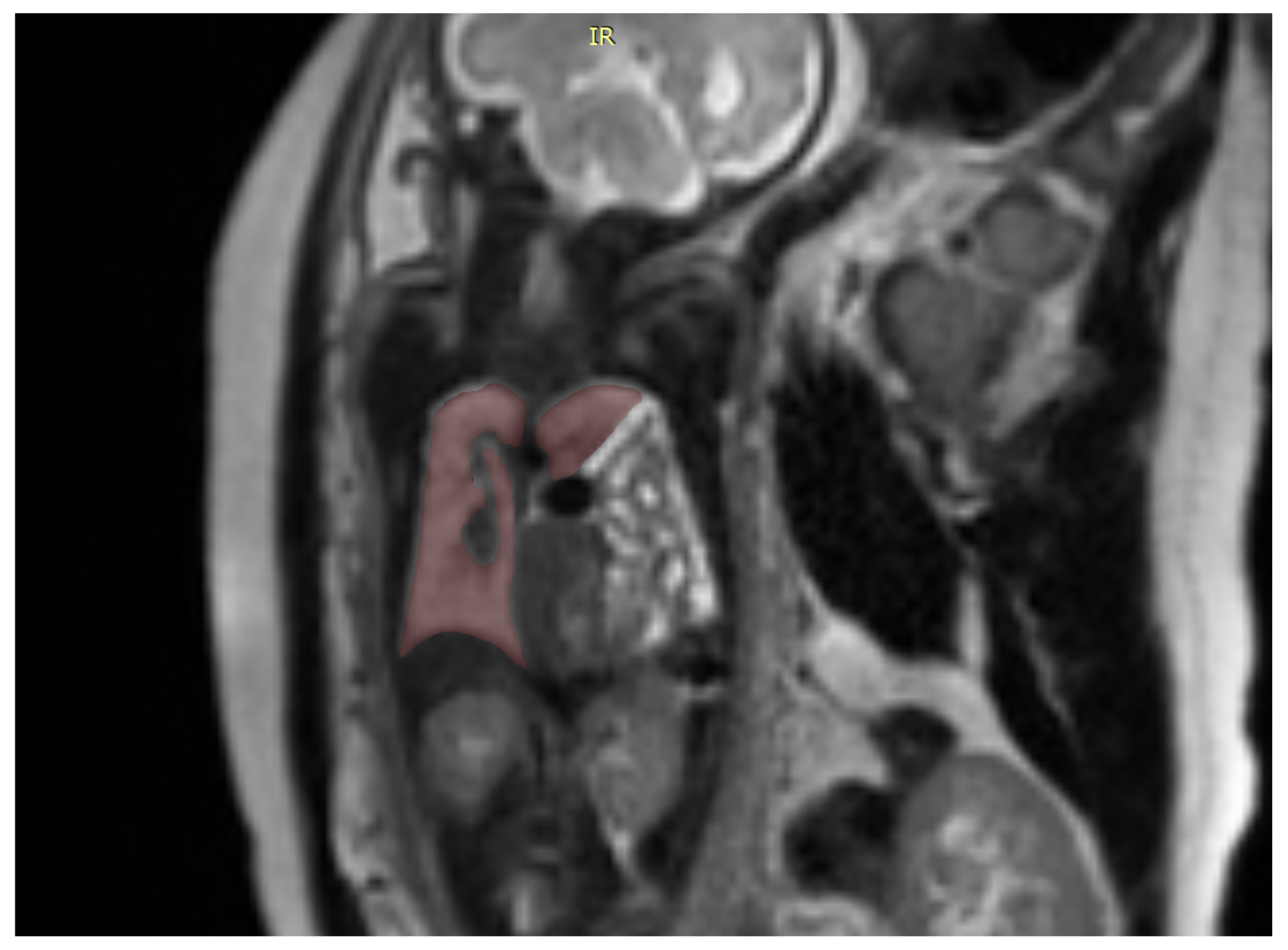 Diagnostics 12 01733 g002