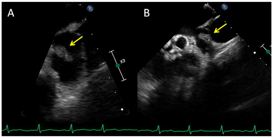 Diagnostics 12 01749 g001a 550