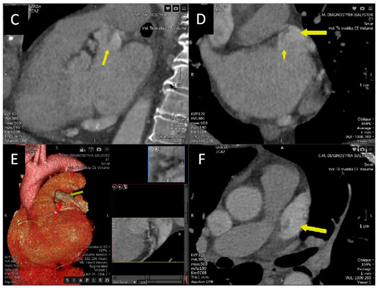 Diagnostics 12 01749 g001b 550
