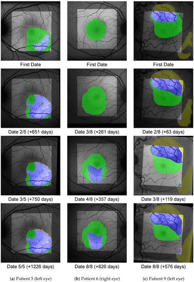 Diagnostics 12 01780 g0a1 550
