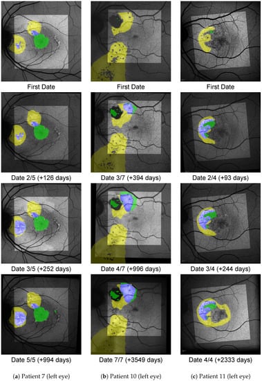 Diagnostics 12 01780 g0a2 550