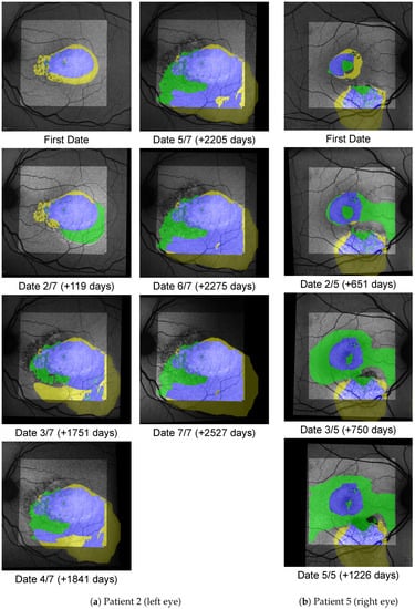 Diagnostics 12 01780 g0a3 550