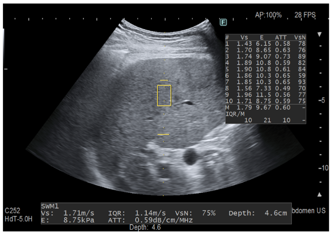 Diagnostics 12 01787 g002