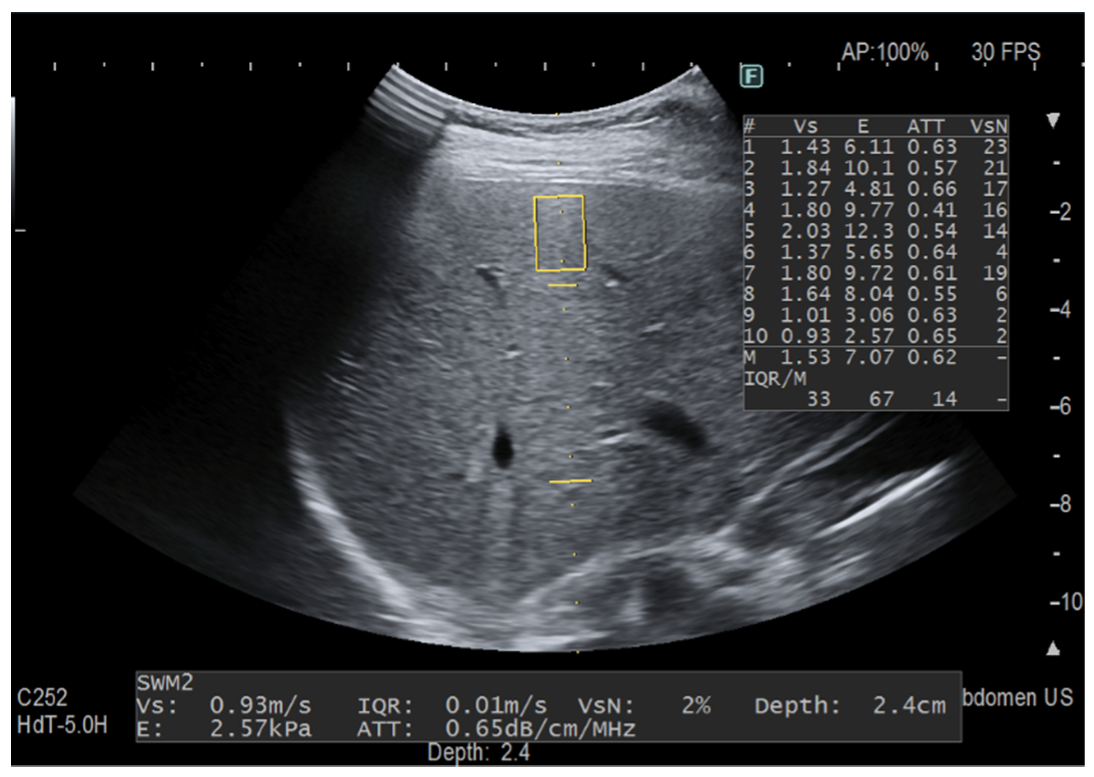 Diagnostics 12 01787 g003