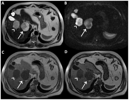 Diagnostics 12 01811 g001 550