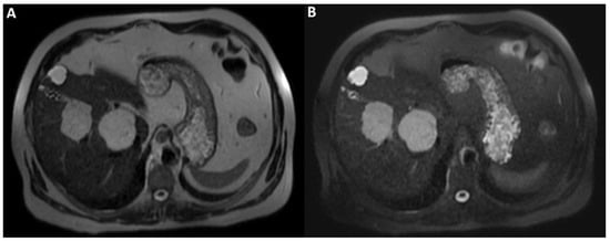 Diagnostics 12 01811 g002 550