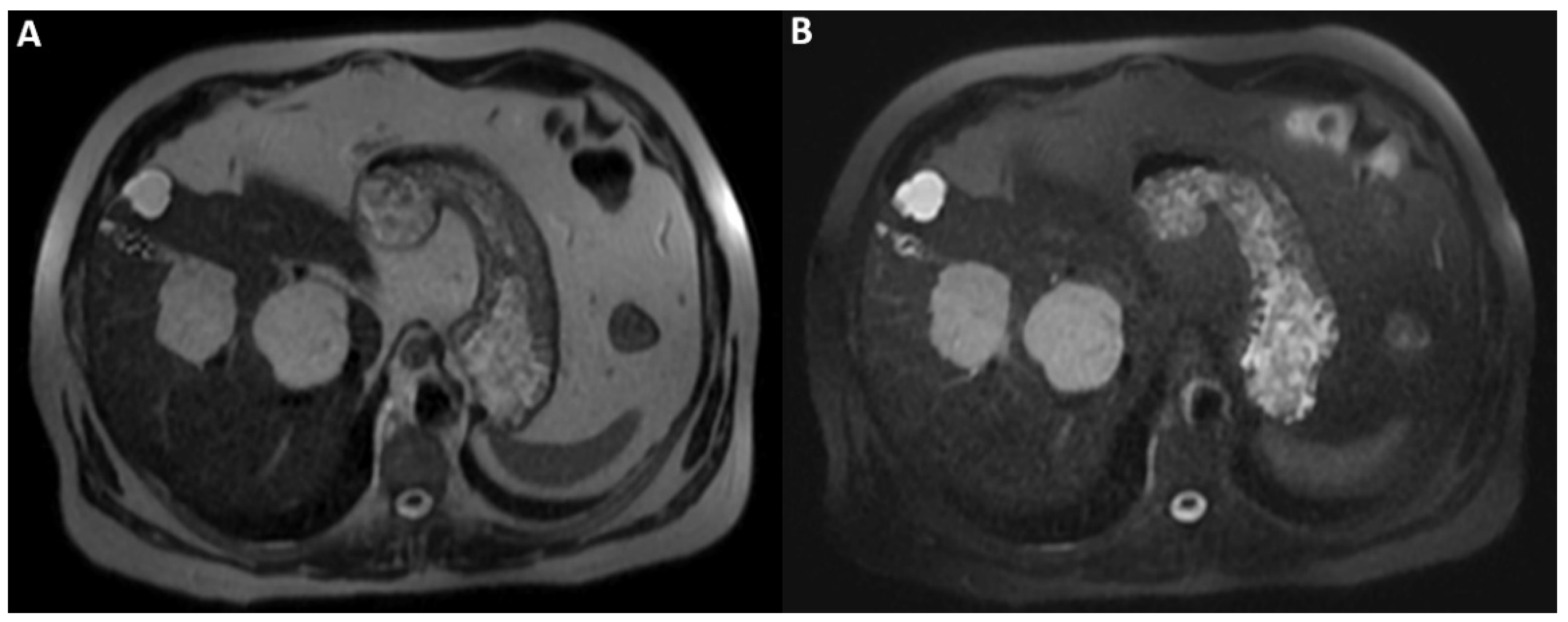 Diagnostics 12 01811 g002
