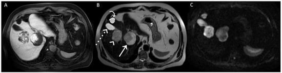 Diagnostics 12 01811 g003 550