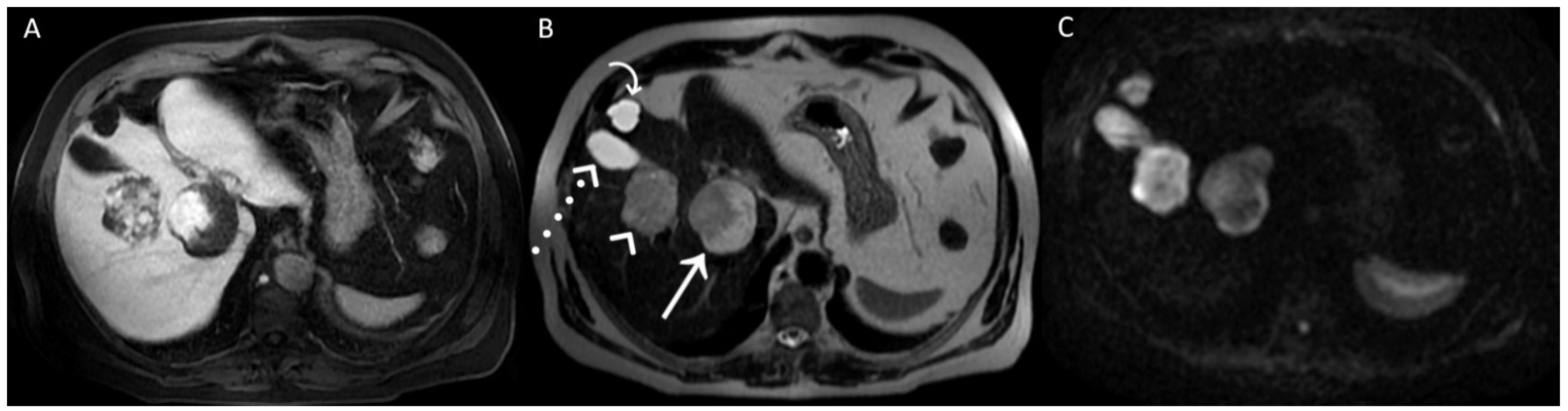 Diagnostics 12 01811 g003