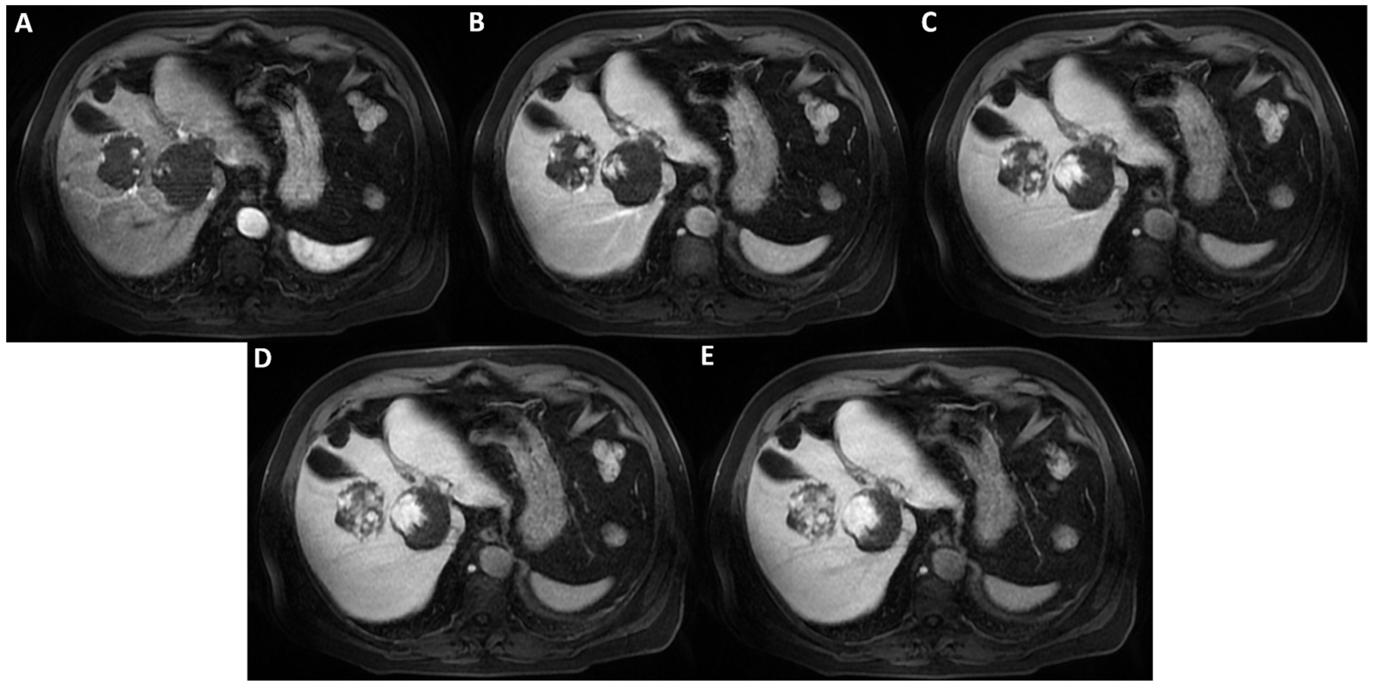 Diagnostics 12 01811 g004