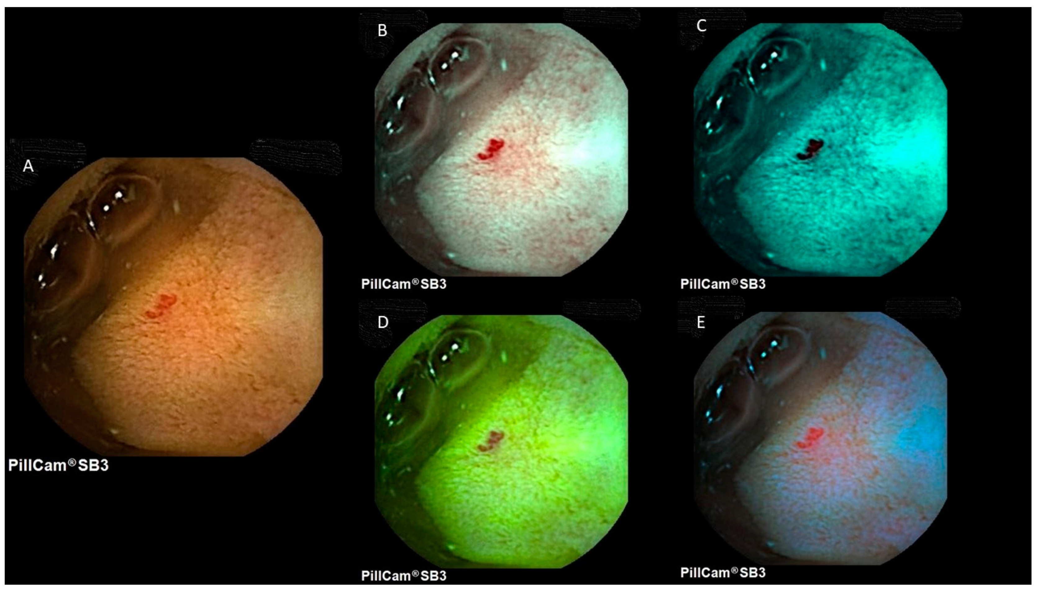 Diagnostics 12 01818 g002