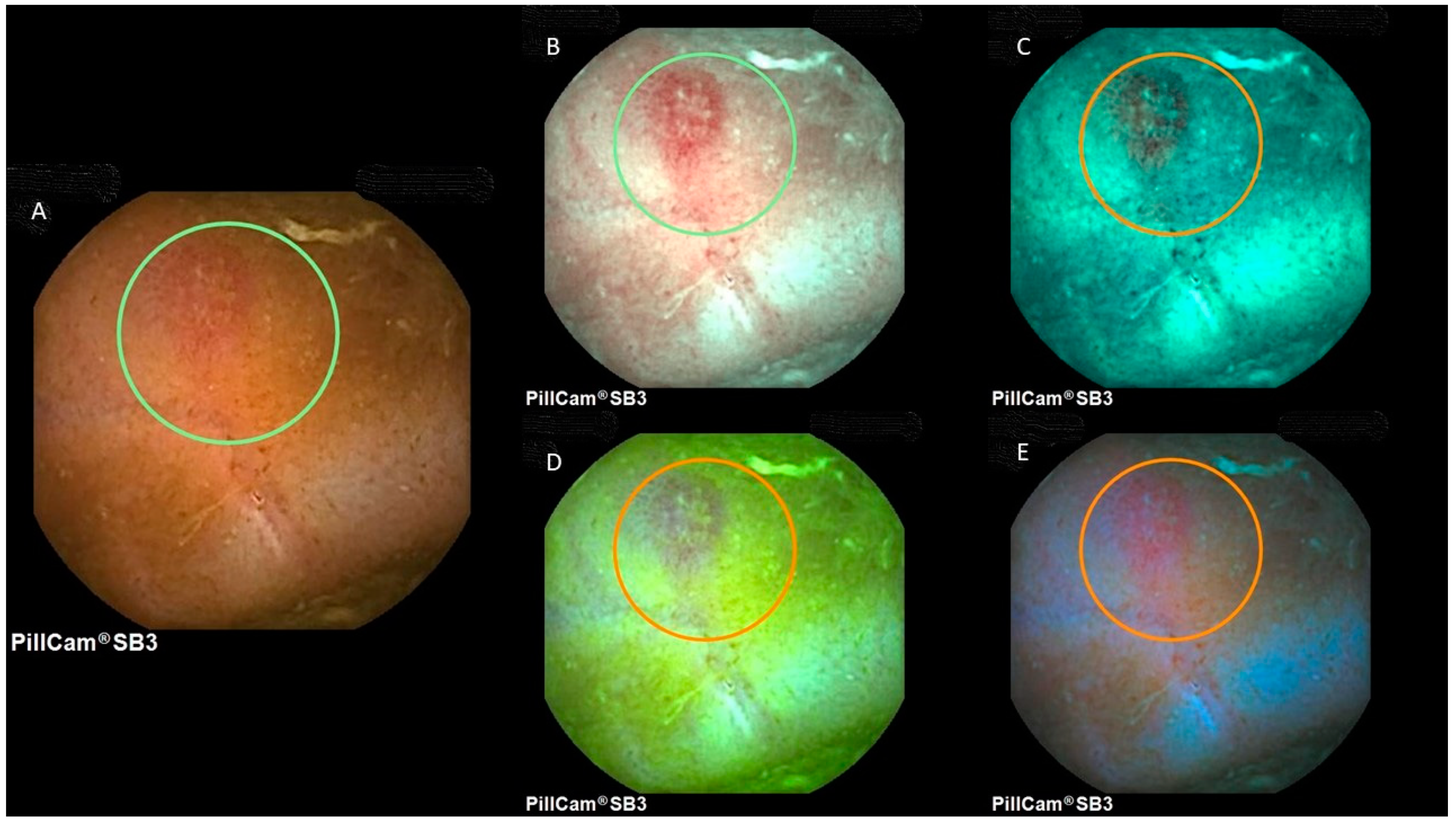 Diagnostics 12 01818 g003