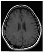 Diagnostics 12 01850 i001