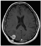 Diagnostics 12 01850 i003