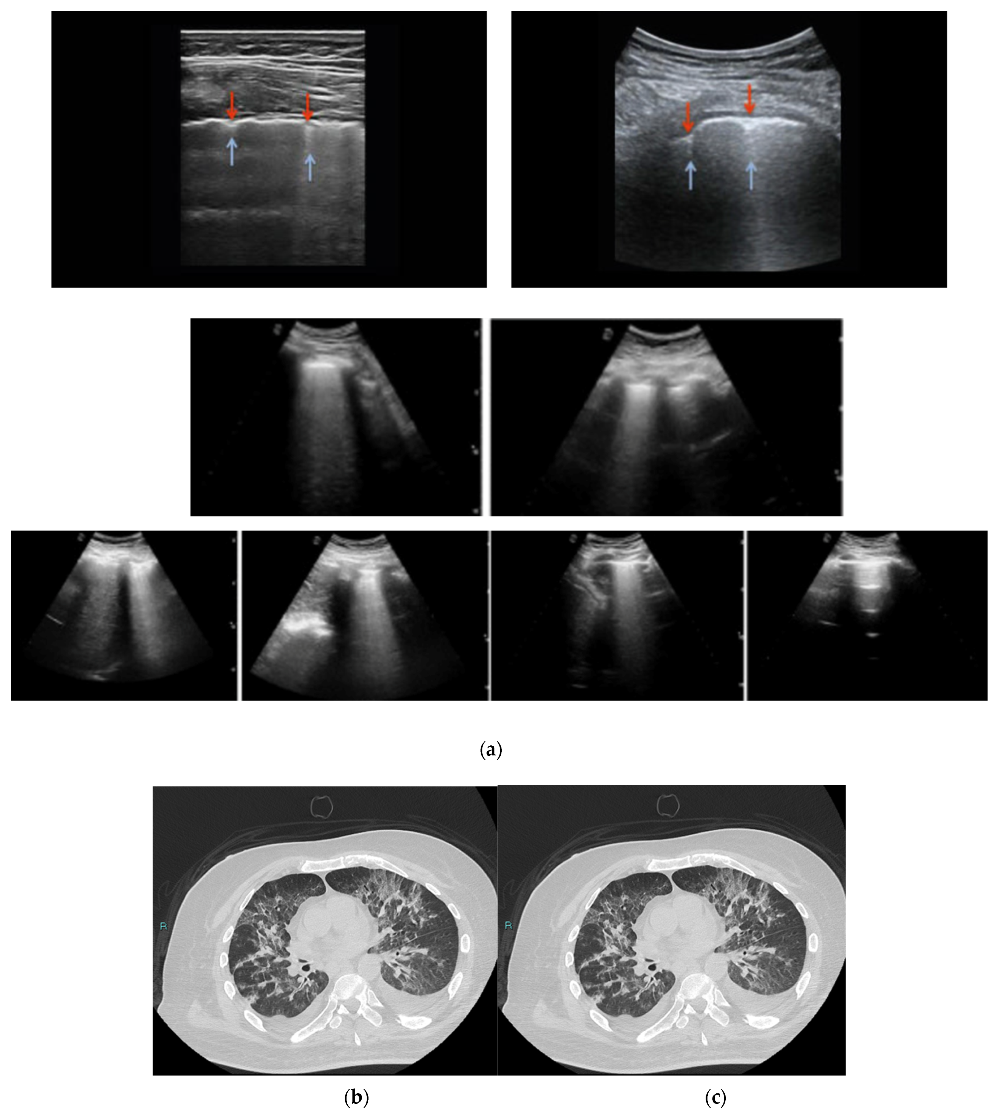 Diagnostics 12 01856 g003