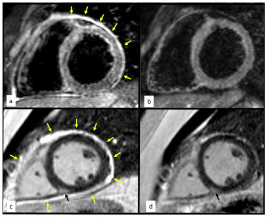 Diagnostics 12 01881 g001 550