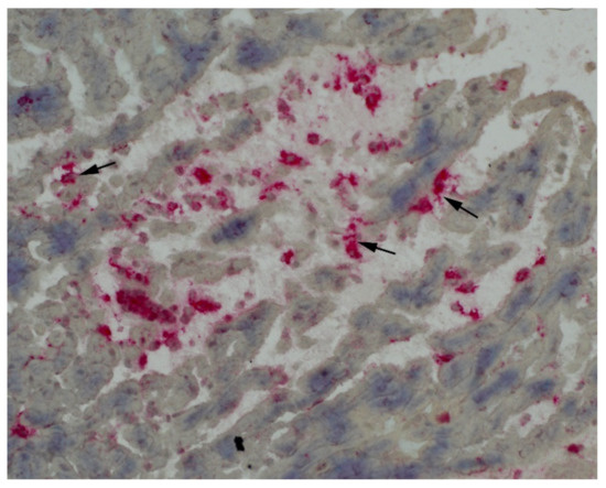 Diagnostics 12 01881 g002 550
