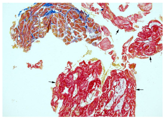 Diagnostics 12 01881 g003 550