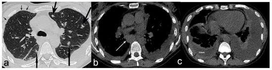 Diagnostics 12 01886 g002