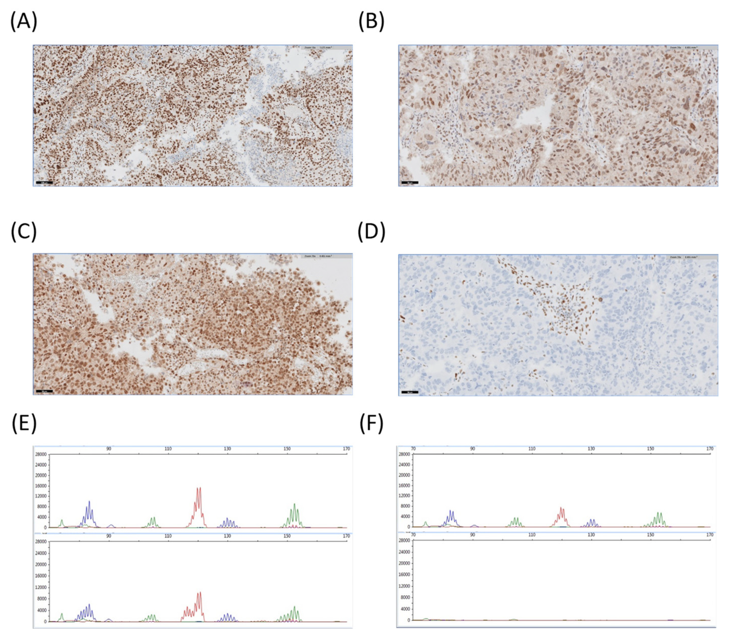 Diagnostics 12 01903 g004