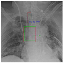 Diagnostics 12 01913 i001