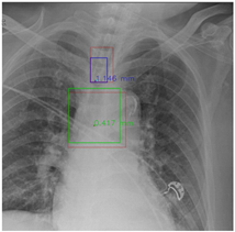 Diagnostics 12 01913 i002