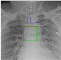 Diagnostics 12 01913 i003