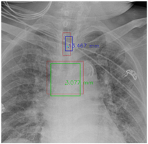 Diagnostics 12 01913 i004