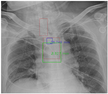 Diagnostics 12 01913 i005