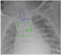 Diagnostics 12 01913 i006