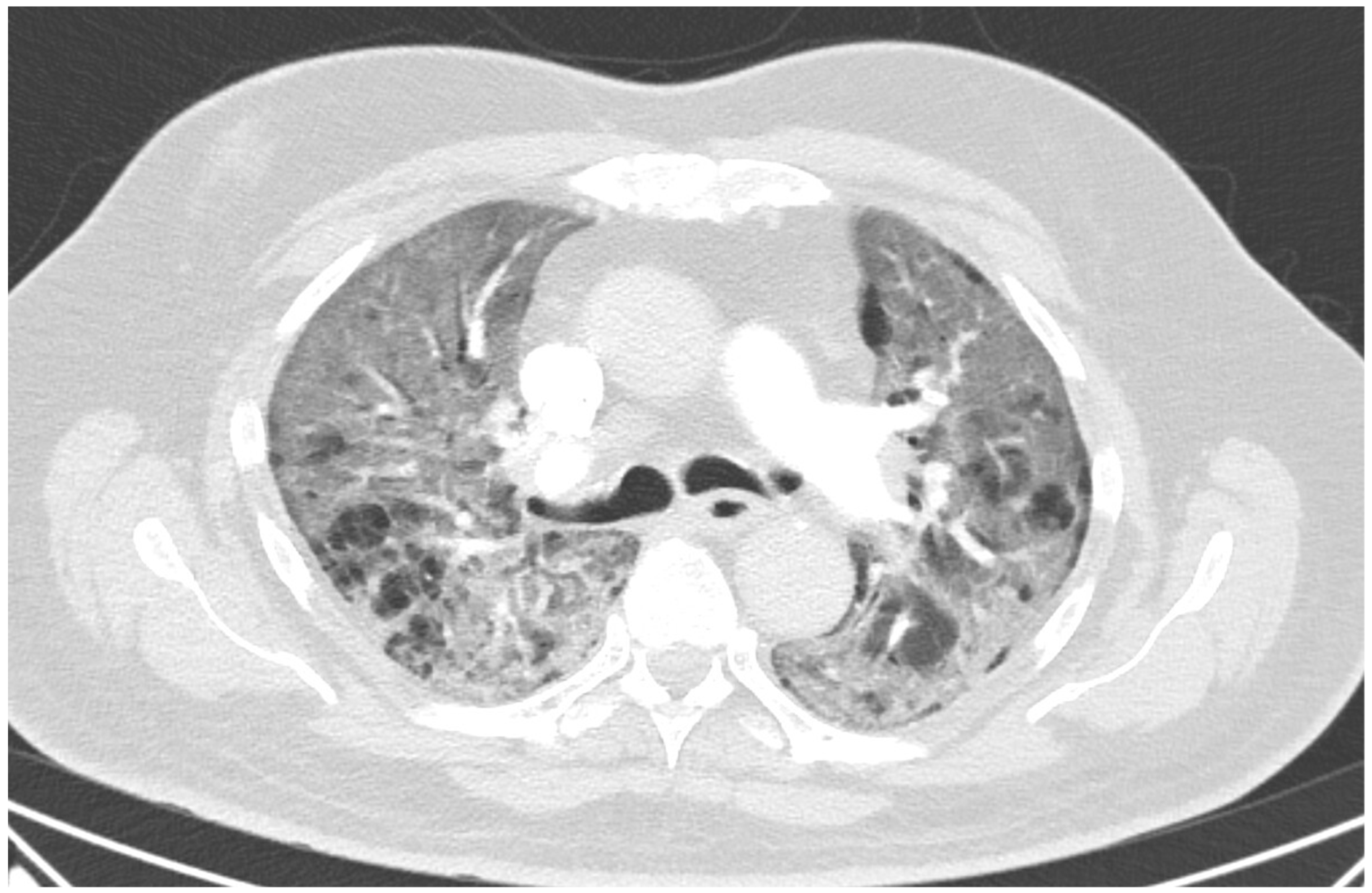 Diagnostics 12 01944 g001