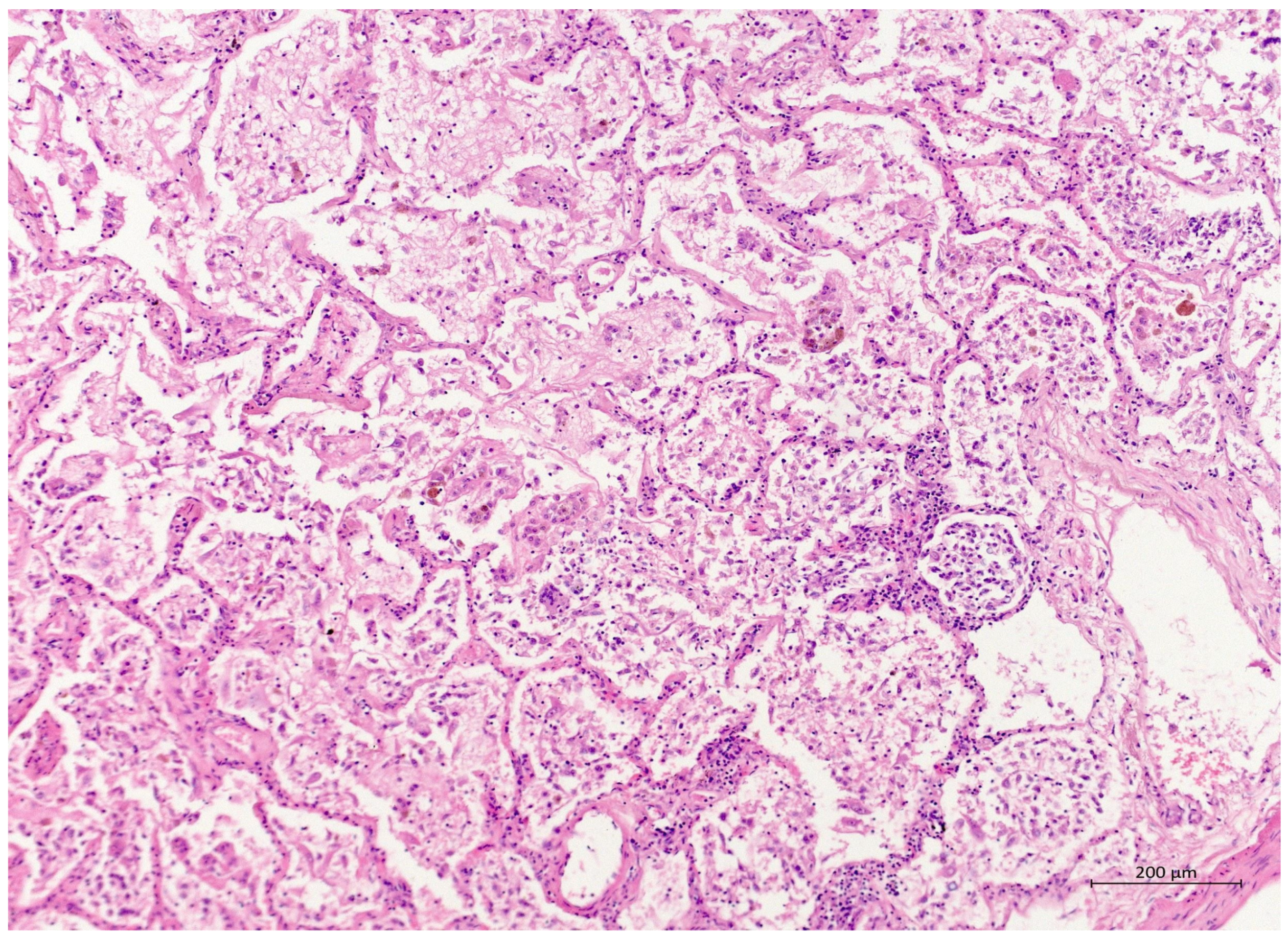 Diagnostics 12 01944 g002