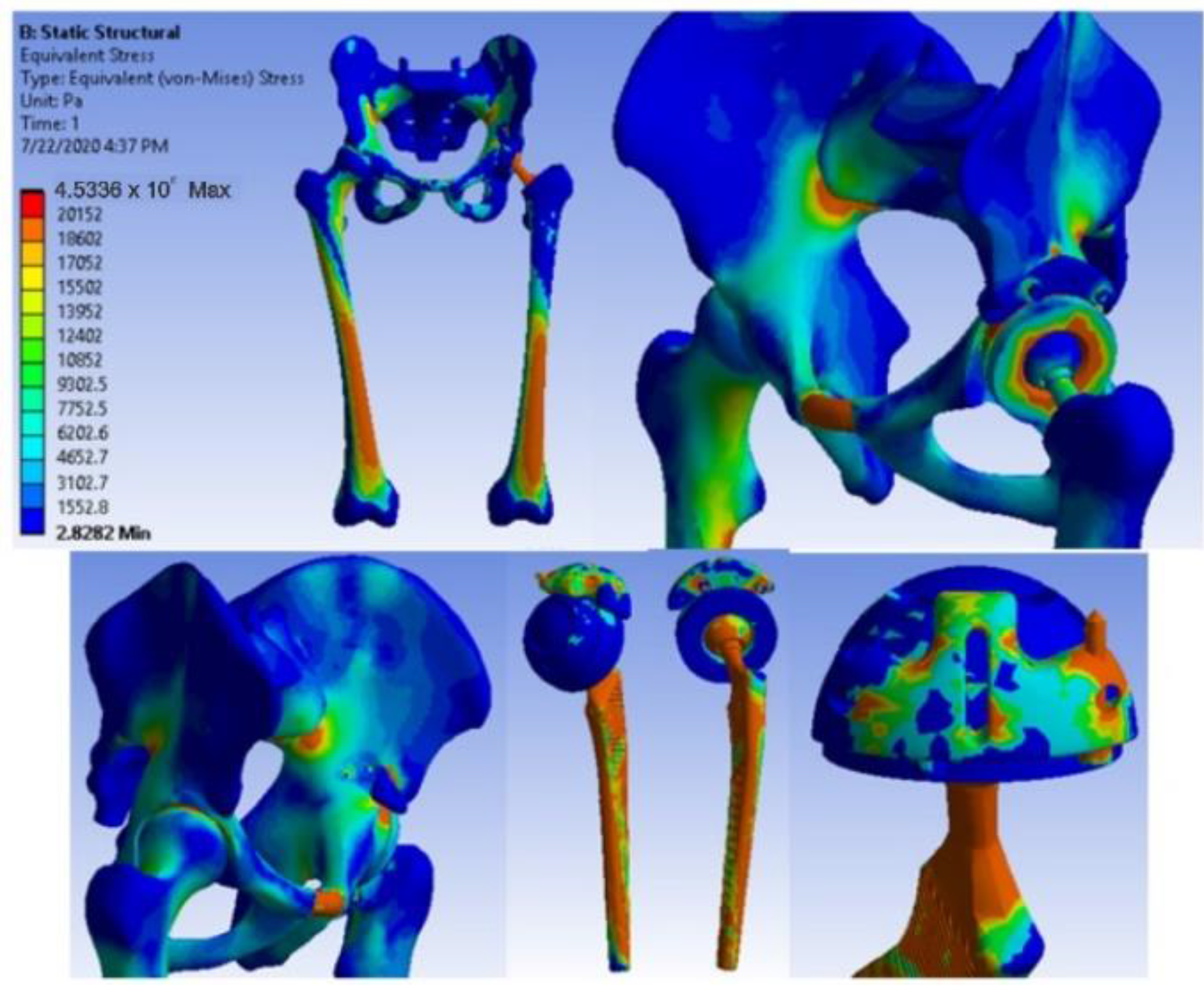 Diagnostics 12 01952 g043