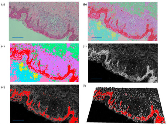 Diagnostics 12 01972 g0a1 550