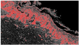 Diagnostics 12 01972 i004