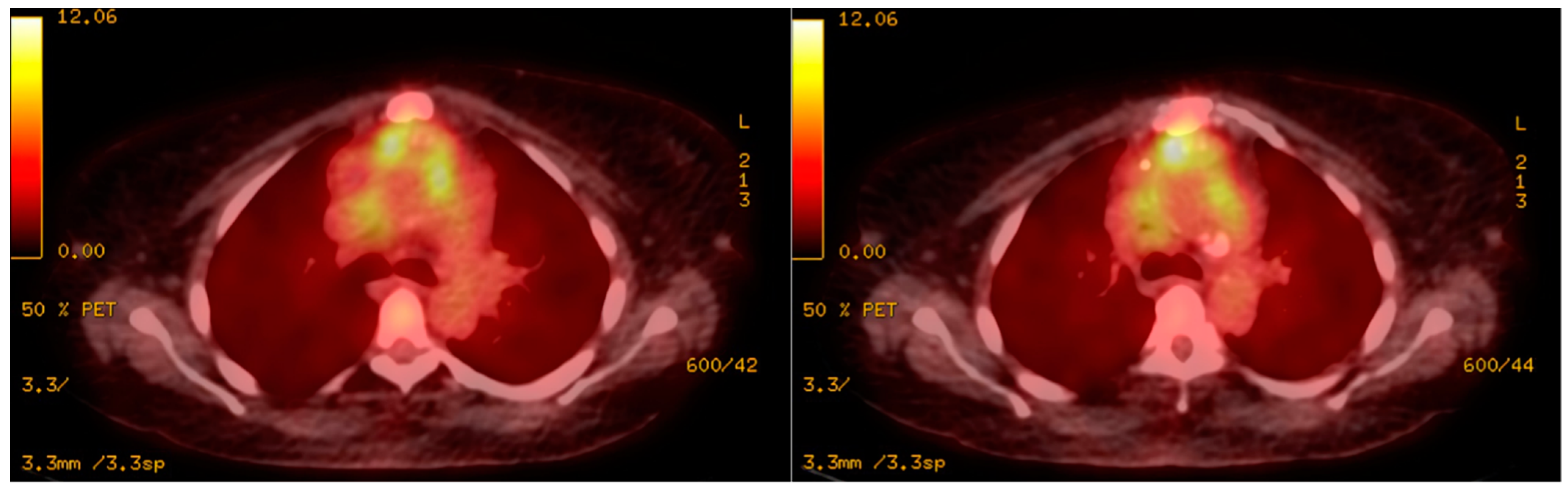Diagnostics 12 01982 g004 Diagnostics 12 01982 g004