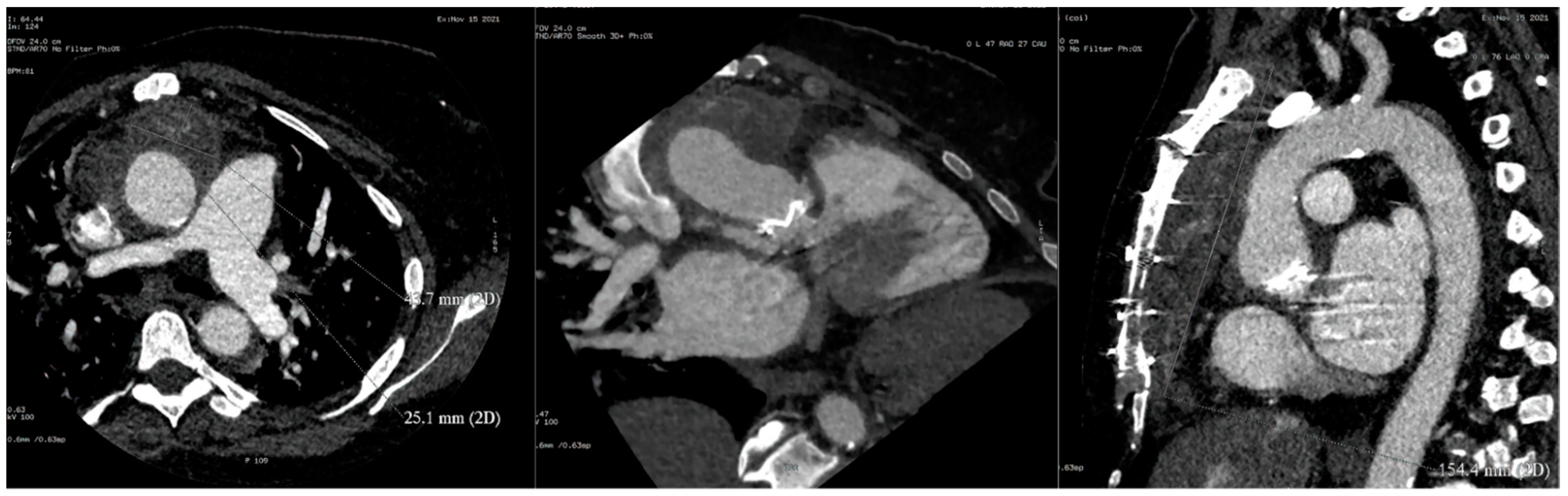 Diagnostics 12 01982 g005 Diagnostics 12 01982 g005