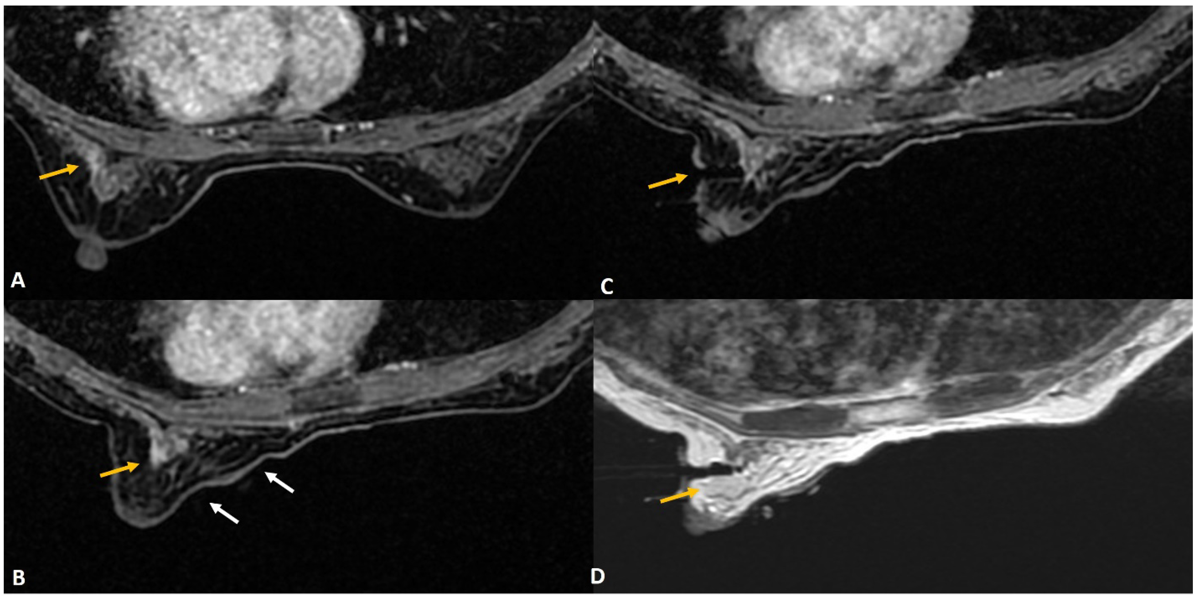 Diagnostics 12 01985 g003