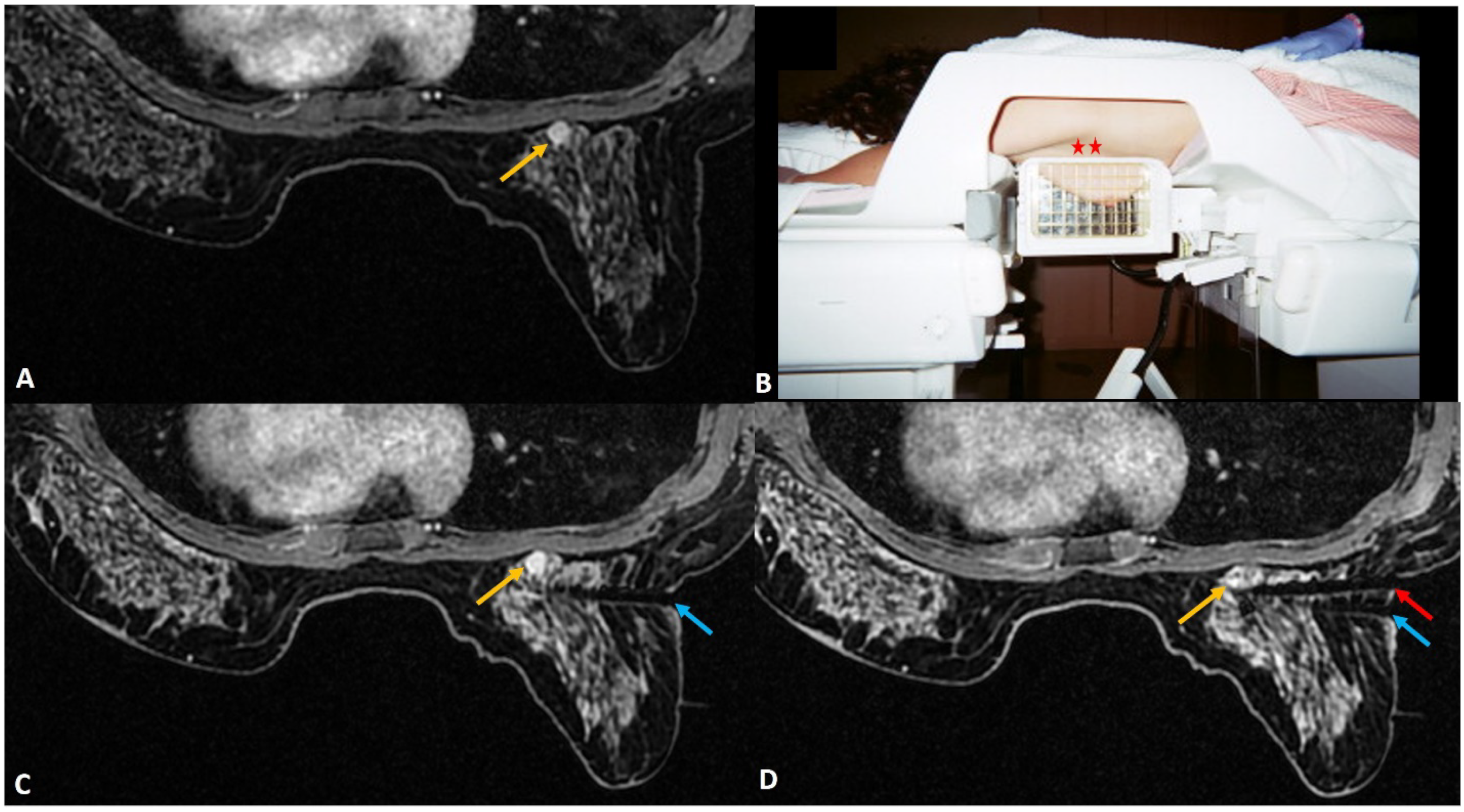 Diagnostics 12 01985 g004