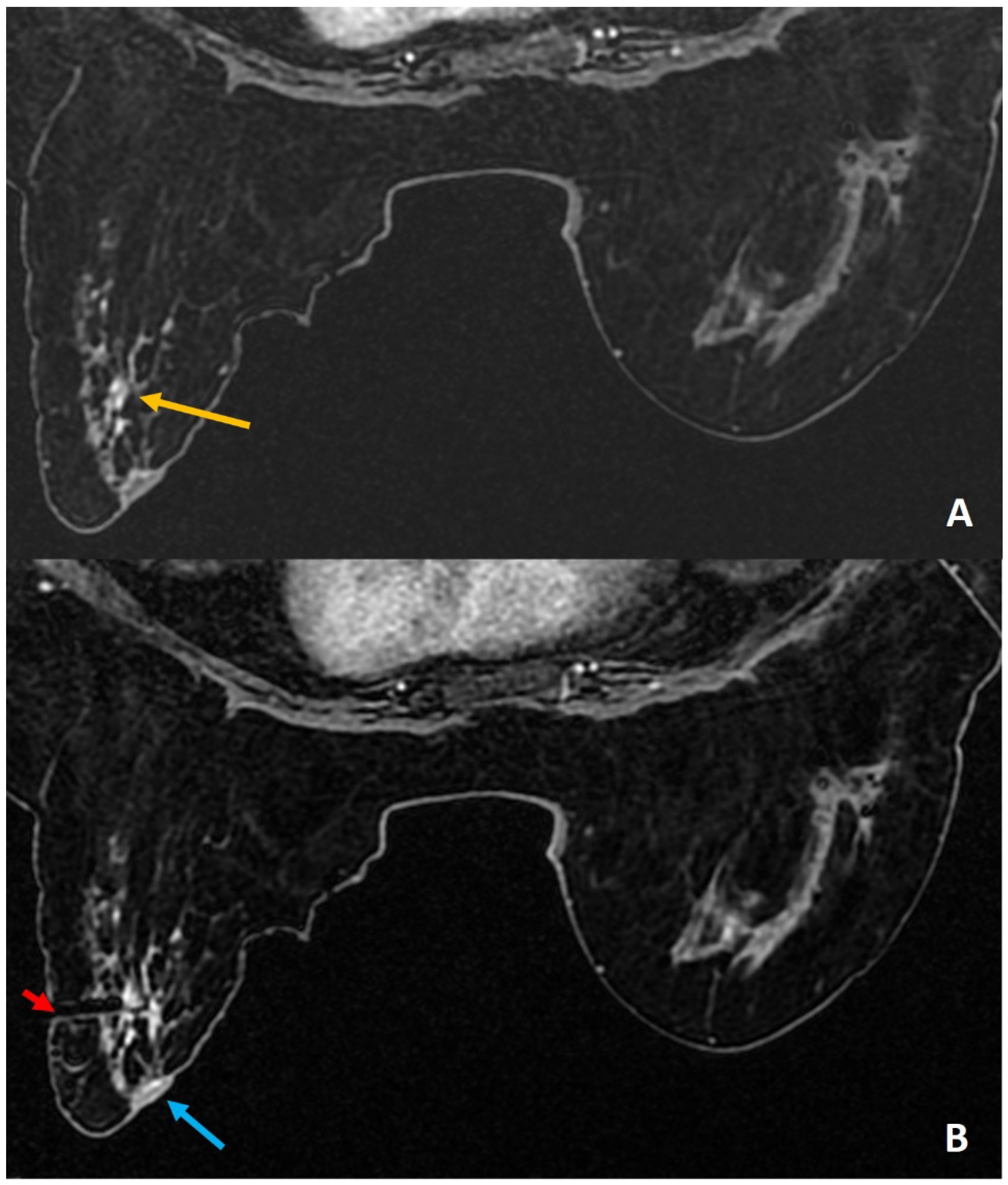 Diagnostics 12 01985 g005