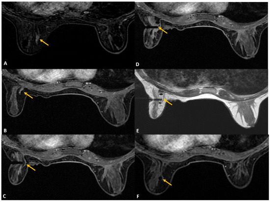 Diagnostics 12 01985 g008 550