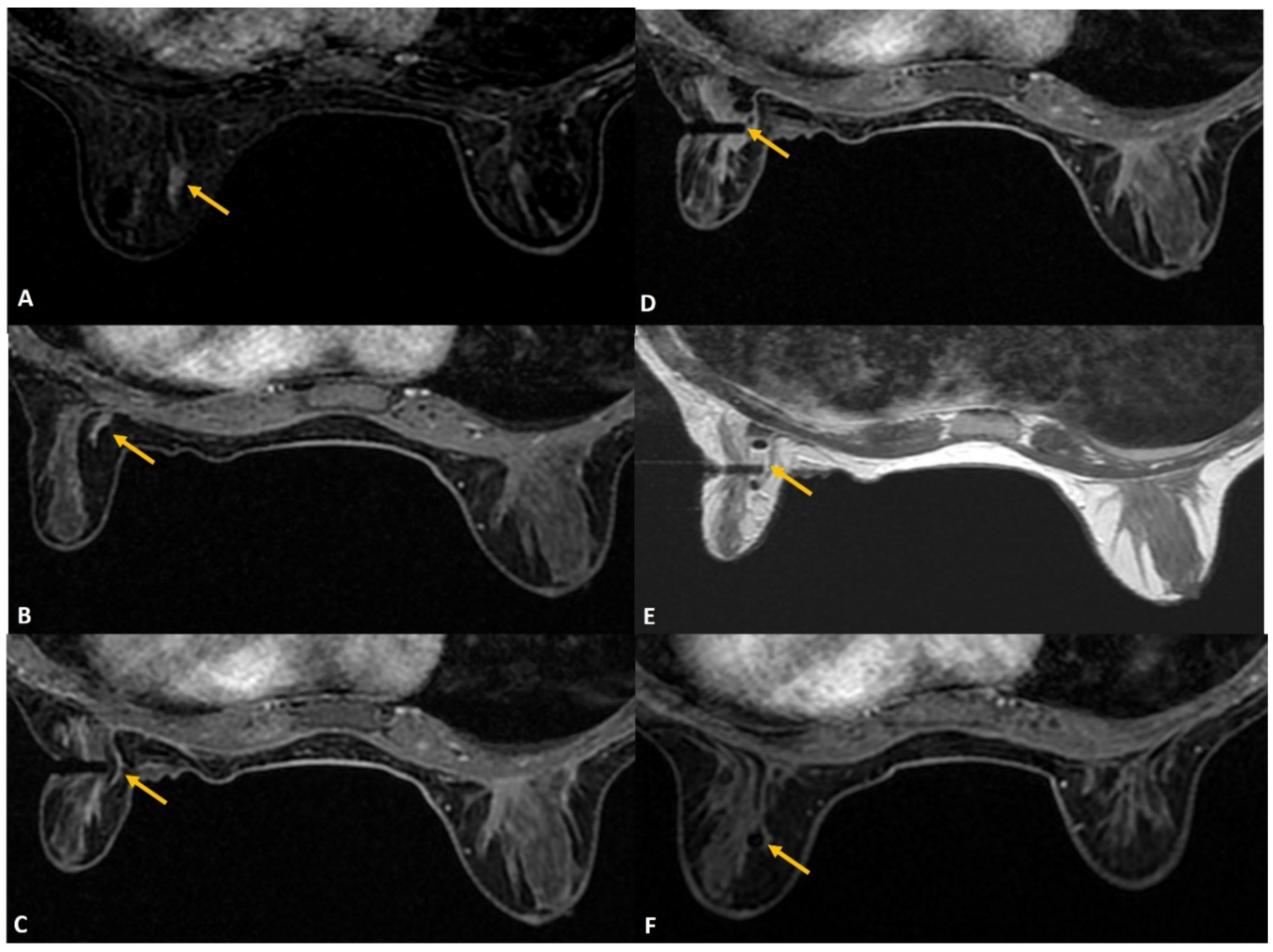 Diagnostics 12 01985 g008